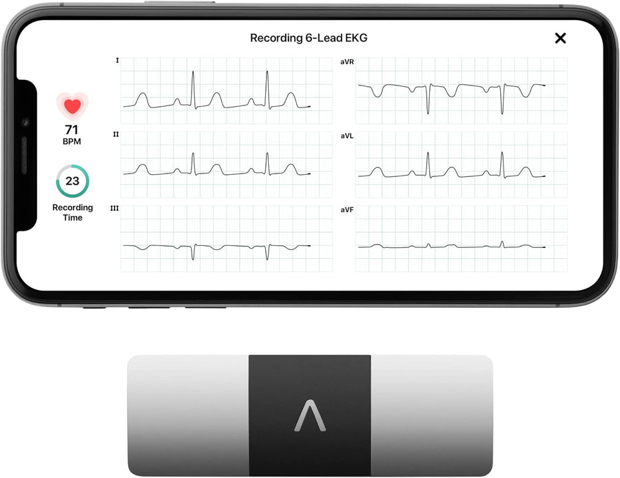 KardiaMobile 6-Lead Personal EKG Monitor, FSA/HSA Eligible - $90